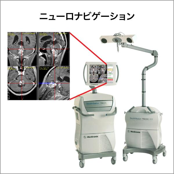図1a　ニューロナビゲーション
