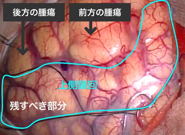 図5-3