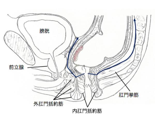 図11