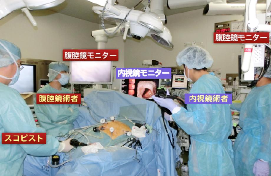 腹腔鏡と内視鏡による合同手術