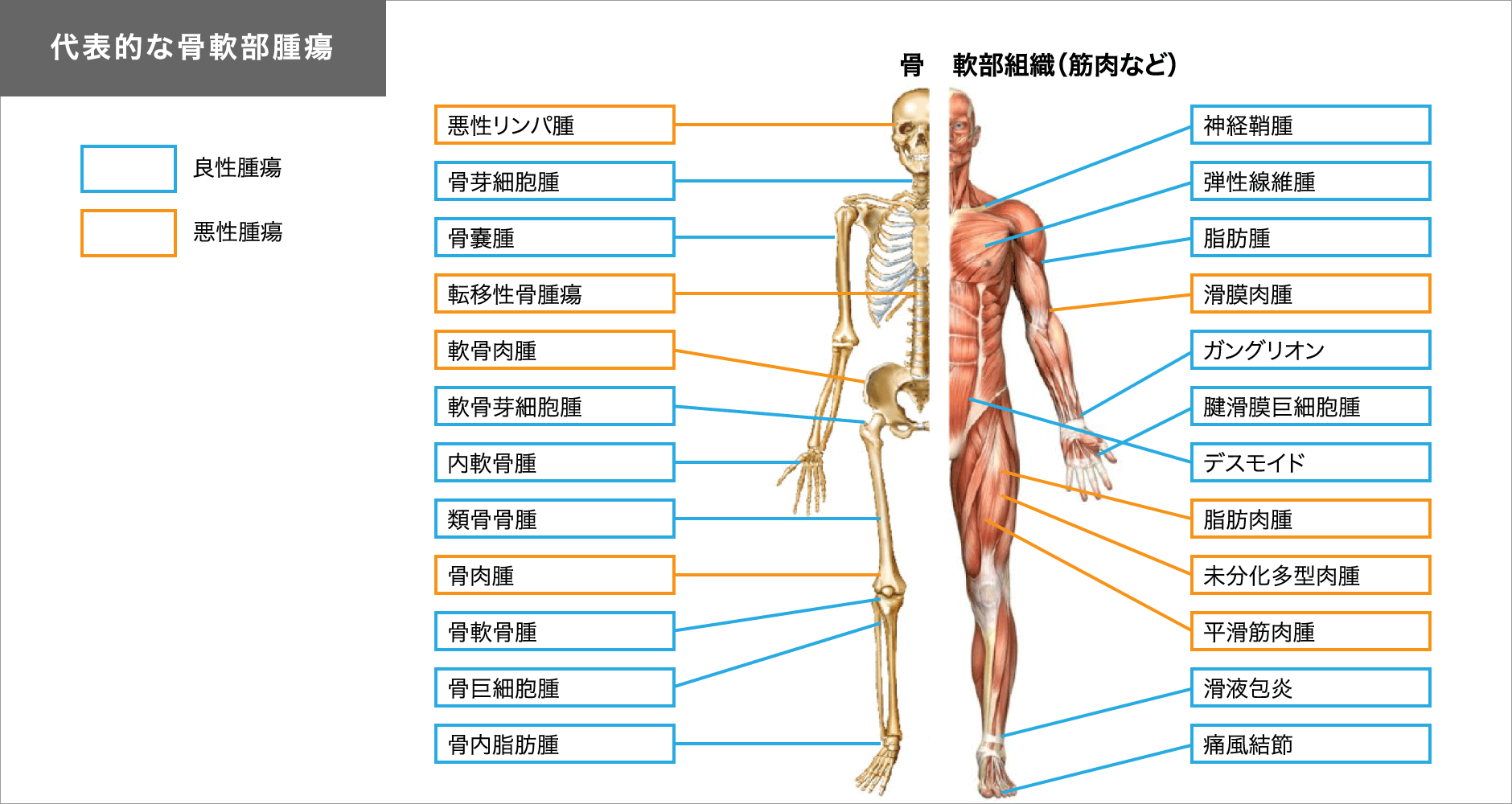 代表的な骨軟部腫瘍