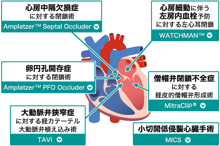 心房中隔欠損症に対する閉鎖術,心房細動に伴う左房内血栓予防に対する左心耳閉鎖,卵円孔開存症に対する閉鎖術,僧帽弁閉鎖不全症に対する経皮的僧帽弁形成術,大動脈弁狭窄症に対する経カテーテル大動脈弁植え込み術,小切開低侵襲心臓手術