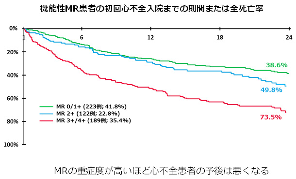 MRの重症度が高いほど心不全患者の予後は悪くなる